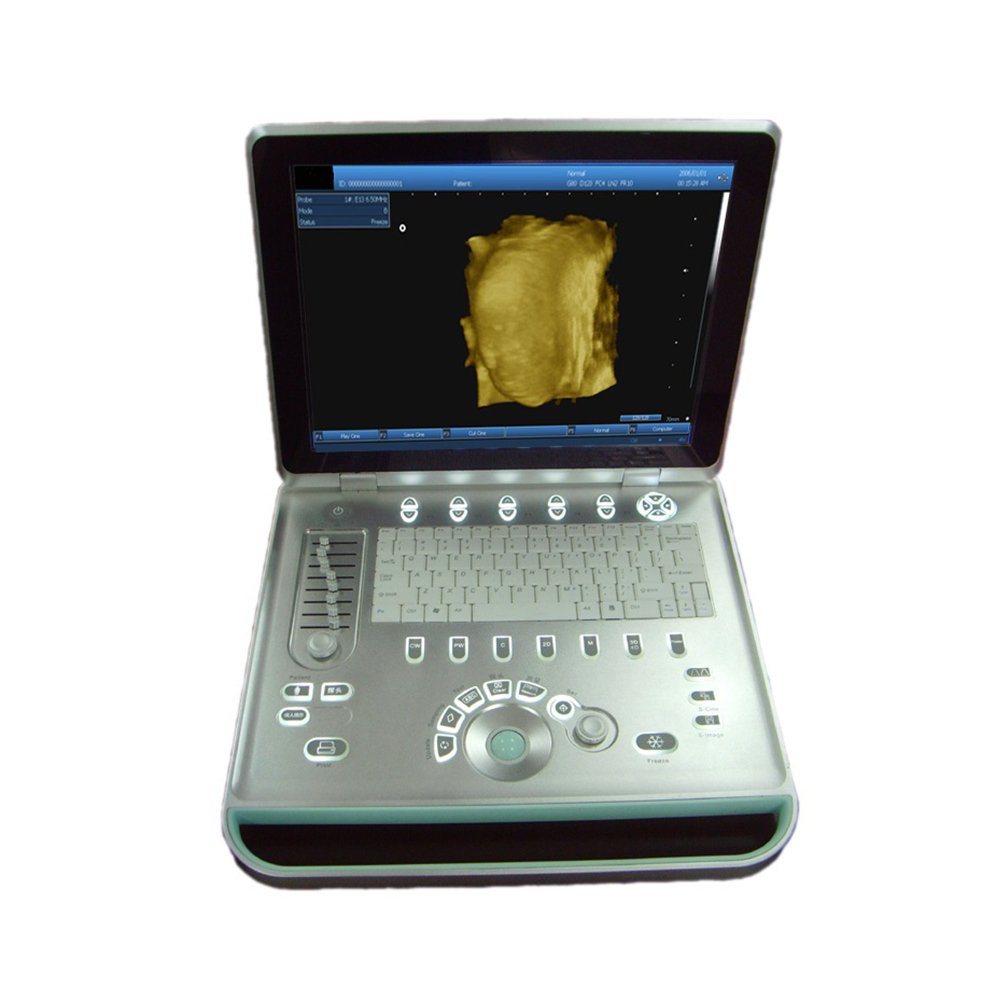 LTUB02 Laptop Ultrasound B scanner