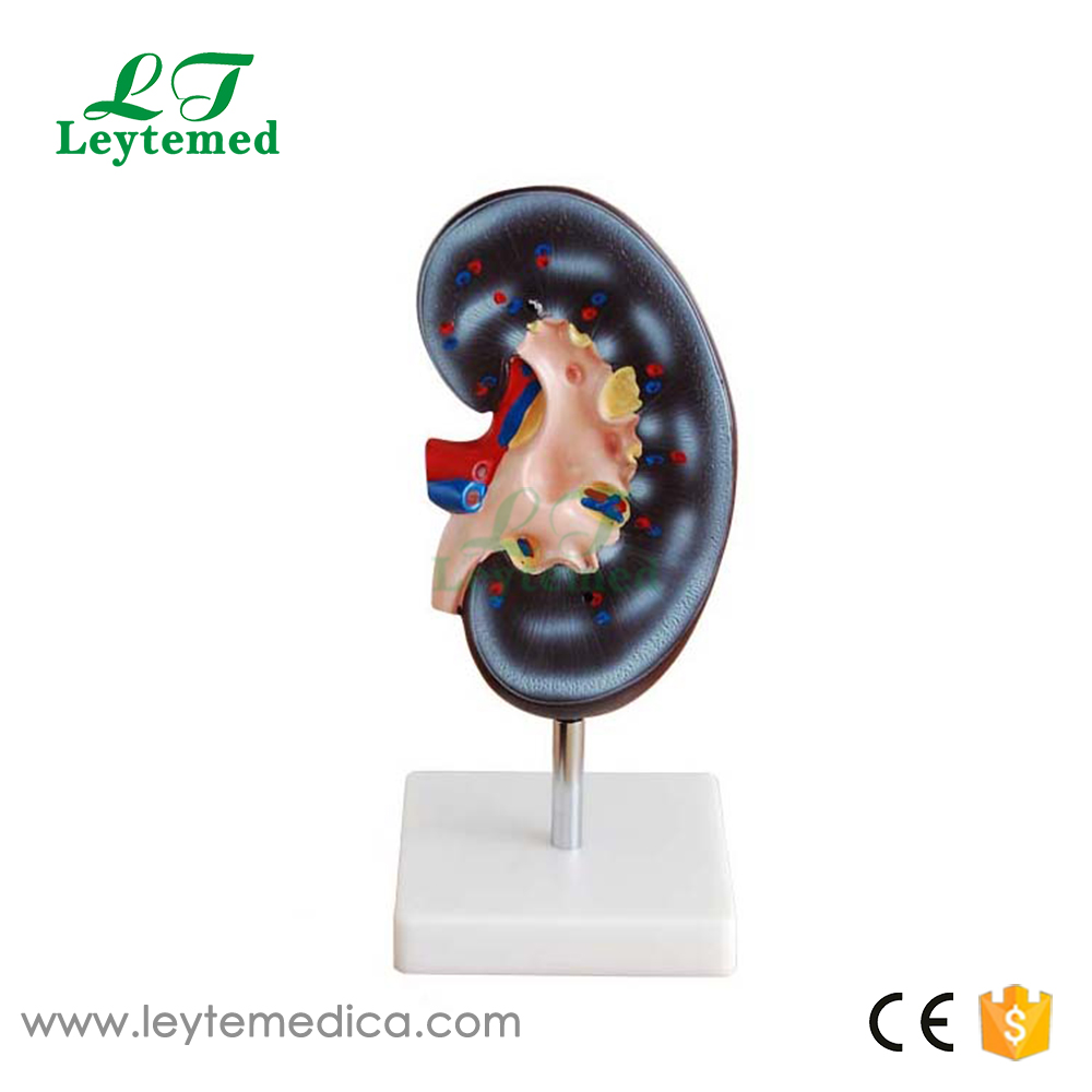 LTM310A Kidney Model (1 Part)