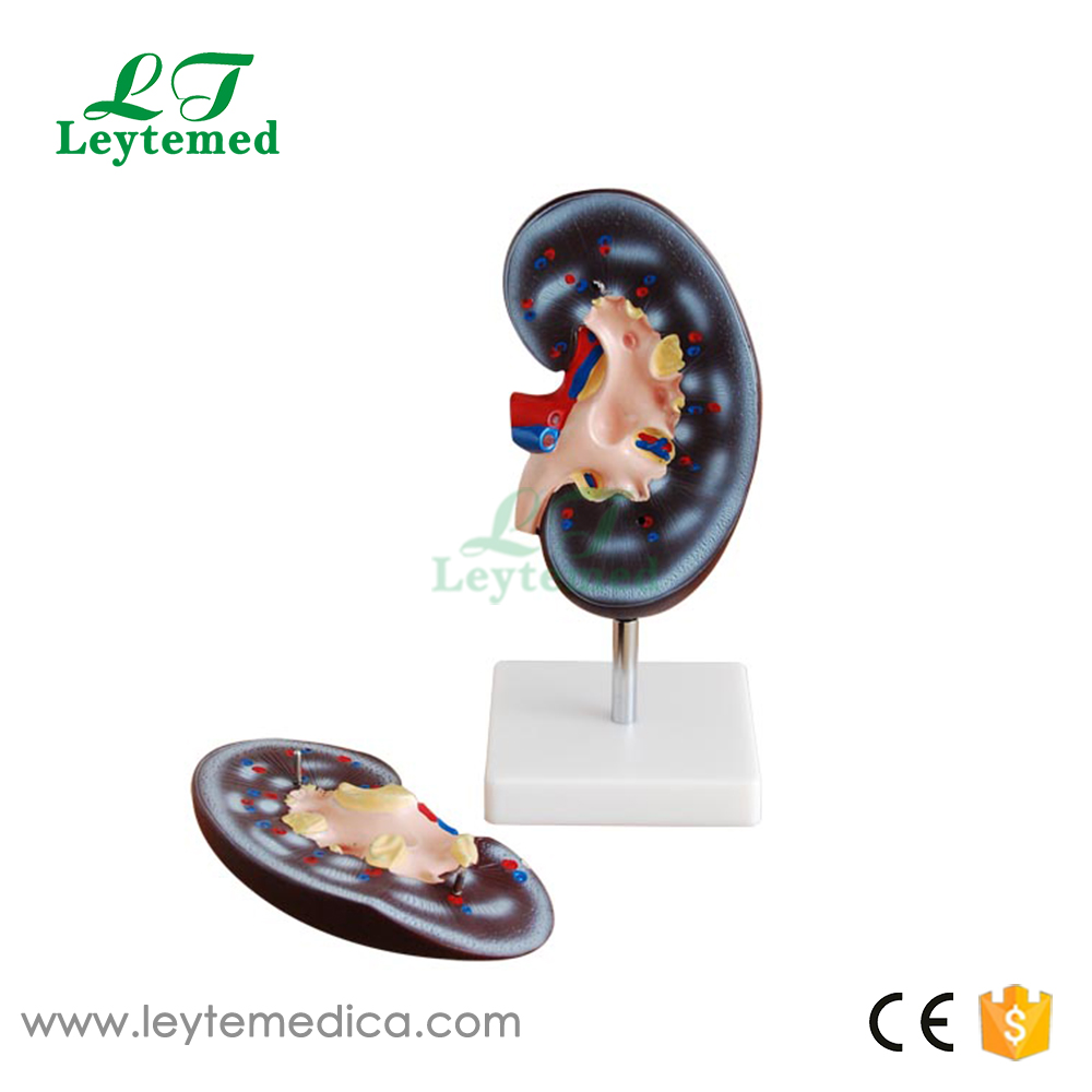 LTM310B Kidney Model (2 parts)