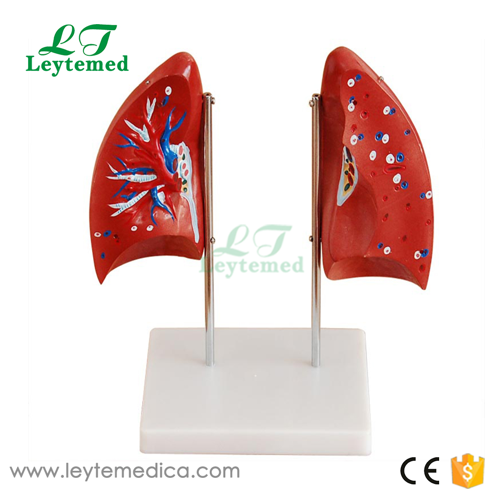 LTM321 Lung Model