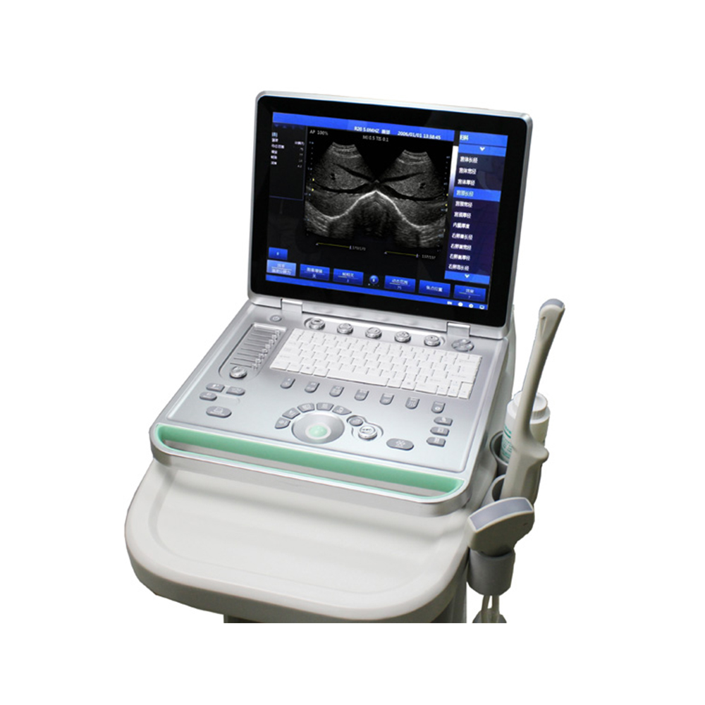 LTUB19V Vet Laptop ultrasound scanner (Arm based)