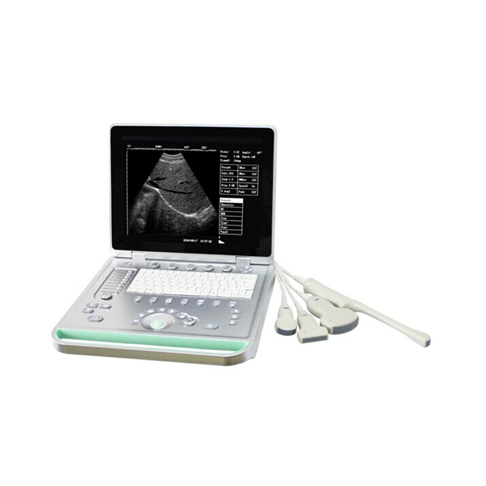 LTUB18V Vet Laptop ultrasound scanner