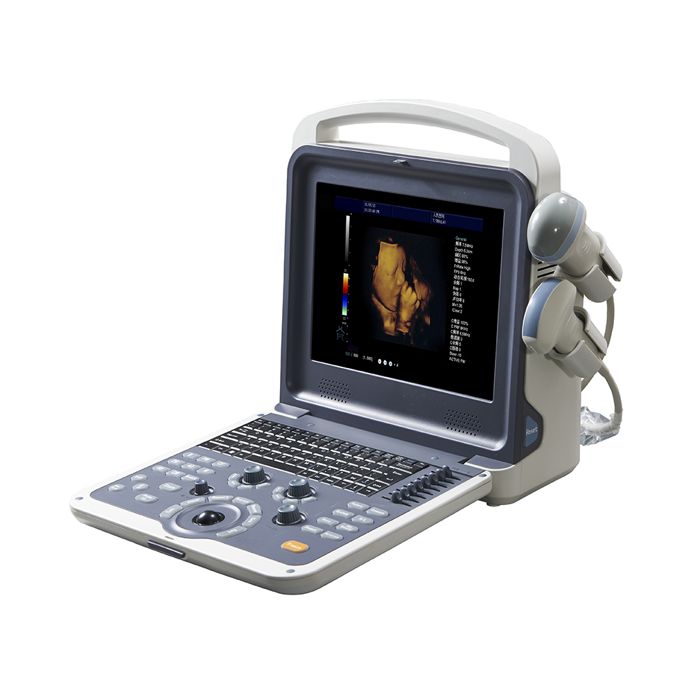 LTUB01 Portable color ultrasound scanner