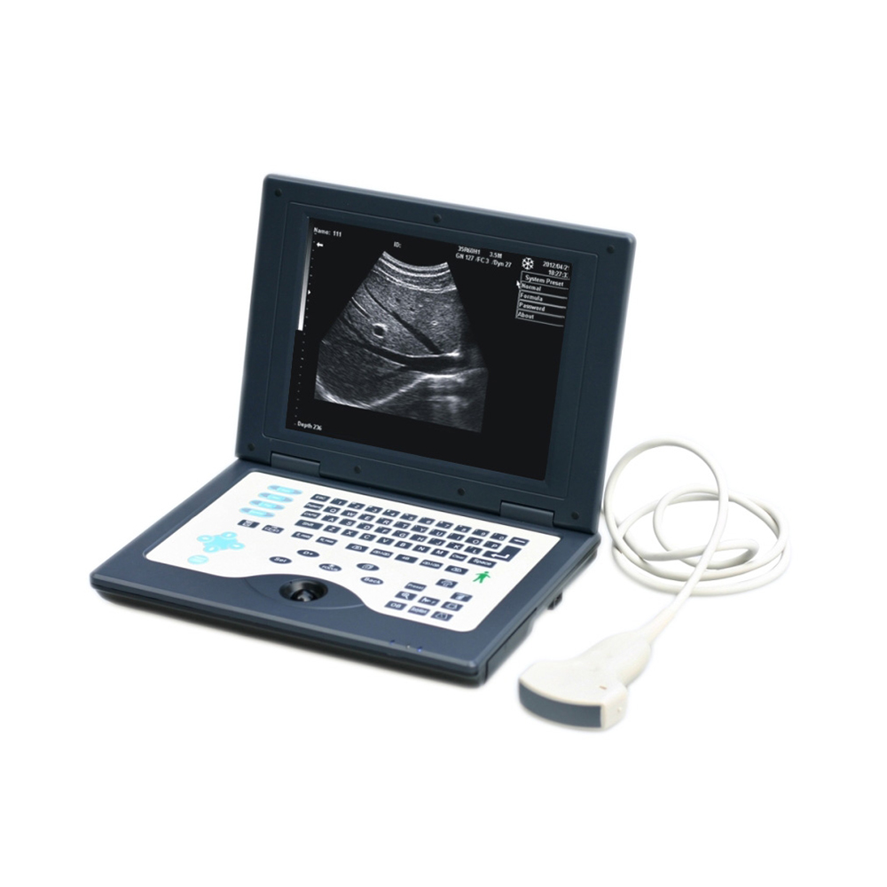 LTUB27 Laptop b ultrasound scanner