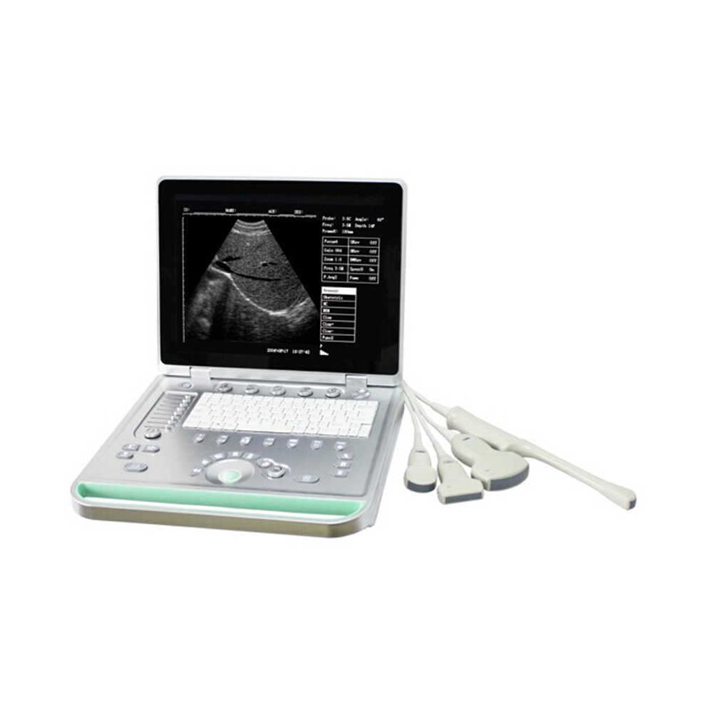 LTUB18 Laptop ultrasound scanner