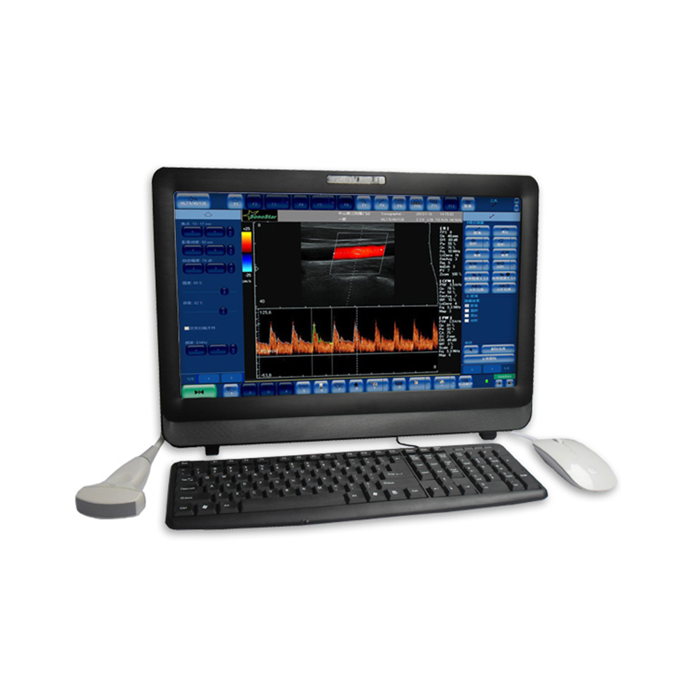 LTUB05 Color Doppler Ultrasound System