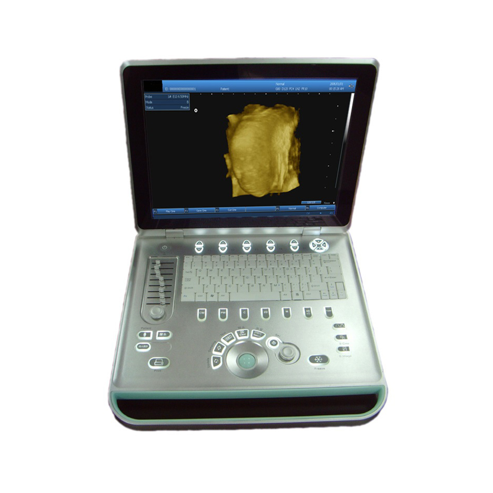 LTUB02V Laptop Ultrasound B scanner for animal